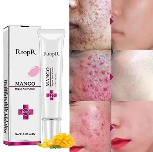 15g Rt0pR Mango Repair Acne c-ream Anti-acne Treatmenskiu