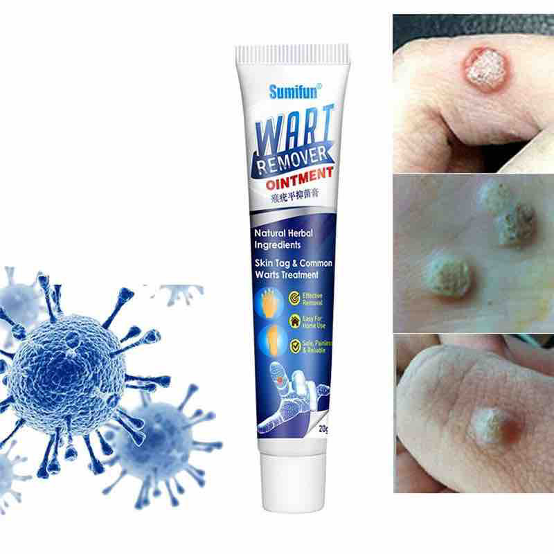 Sumifan Wart Remover Ointment Essence -20g