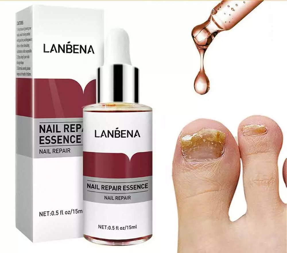 Shopee LANBENA Nail Repair Essence Serum Fungal Nail Treatment Remove