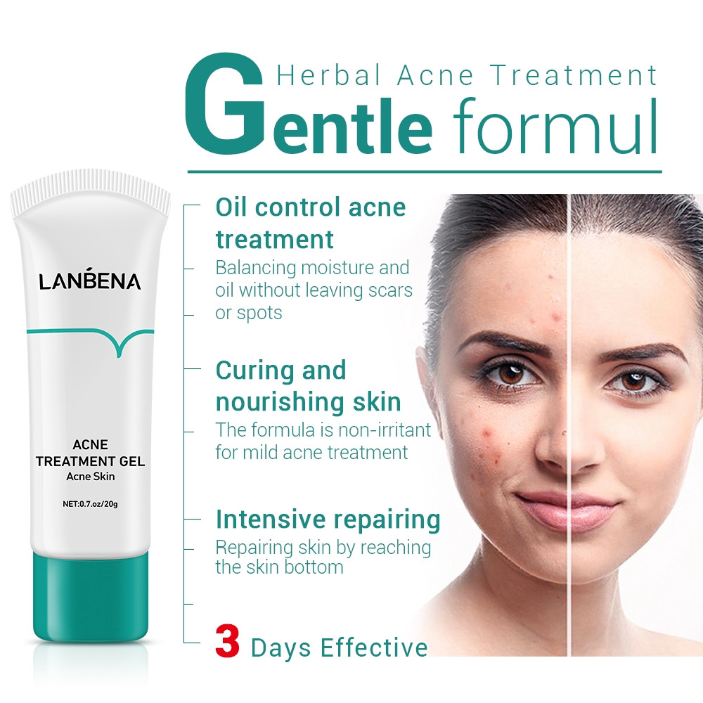 LANBENA Acne Treatment Gel Acne Cleaning Creaem Blackhead Remover Acne Spots Face Acne Scars Skin Care Repair Comedone Pimple